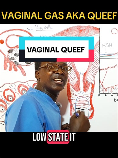 Understanding Vaginal Flatulence: Causes and Remedies