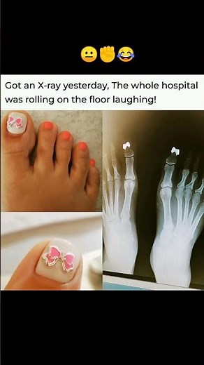 x-rays memes 😁just for fun! #radiologylectures #radiologymemes #radiologyfunny