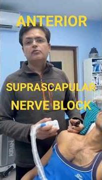 Anterior Suprascapular Nerve Block (Ultrasound-Guided) | Real Sono-Anatomy, C5–C6–C7 Identification