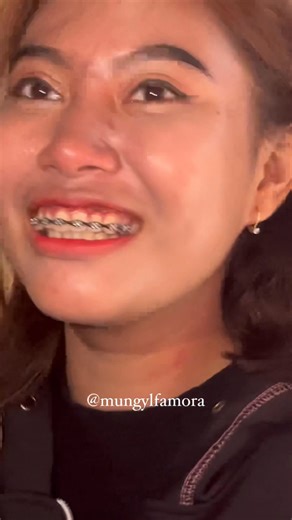 L3m3s gebi wik bi4n knce brye b4ru ne🤣 #reels #fyp | Mungyl Famora