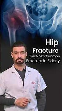 Hip fractures in the elderly | Hip Fracture | Hip Fracture Surgery | Orthopedic Surgery