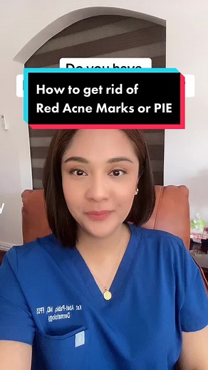 How to Fade Red Acne Marks or PIE Quickly