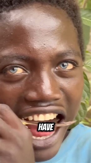 African Tribe With Blue Eyes 😍❤️ | Leo Mike