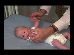 Pediatric Neurologic Exam: Abnormal Newborn