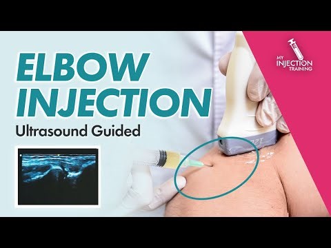 Ultrasound Guided Elbow Joint Injection (Step-by-Step)