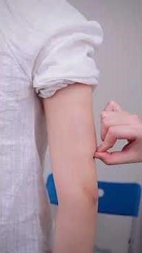 Heal Faster with Scar Tape| Makeup Tutorial