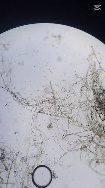 Exploring Mold & Mycelium Under the Microscope