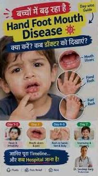 बच्चों में दानों की बीमारी? Hand Foot Mouth Disease | Day 1–7 Symptoms & Treatment | Dr Sandeep Garg