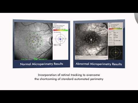 The Optos OCT SLO Imaging System for Retinal Analysis