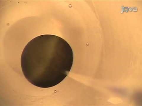 Microinjection of Xenopus Laevis Oocytes