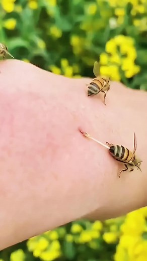 How to Remove a Bee Stinger the Right Way 🐝😳❤️ . . . #Didyouknow #dailyfacts #factsyoudidntknow #sciencefactslover #inspiration | How Facts