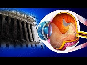 Retinal detachment
