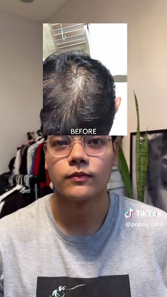 Hair Growth Journey: Before and After Transformation
