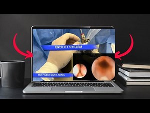 One of the most challenging cases I've operated on (UROLIFT)