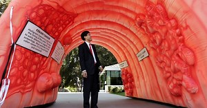 Colon Cancer Can Be Prevented and Treated