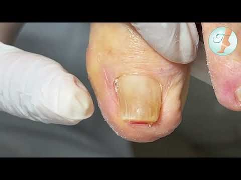 Better to put it back again, right? What do you think?