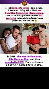 She Has a Rare Skin Condition, But Found True Love! 🥺❤️ #sad #usa #foryou #couple #emotionalstory