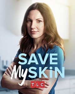 Save My Skin: I Wish I Had A Normal Body