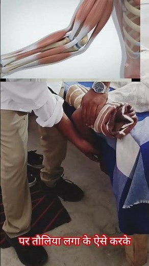 Elbow stiffness exercise & mobilization exercise