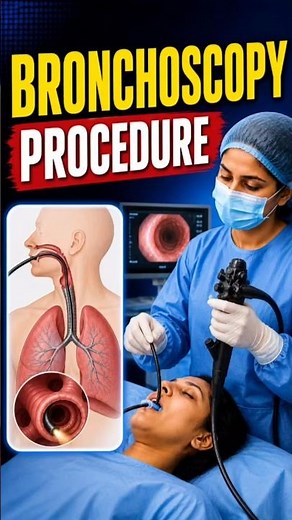 Bronchoscopy Procedure #bronchoscopy #3d #anshunwa