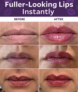 Get plumper, firmer and fuller lips in 30 seconds! If you’re over 40 and still using lip plumpers made for younger skin, it could be doing more harm than good. Your lips need something tailored to your stage of life—like Fulluptuous Lip Plumper Hydrator. Designed specifically for women over 40, it hydrates, smooths, and gives you naturally fuller lips INSTANTLY without the sticky mess. Don’t let another day go by with a formula that’s not made for you. Take the 60-second quiz now to find your pe