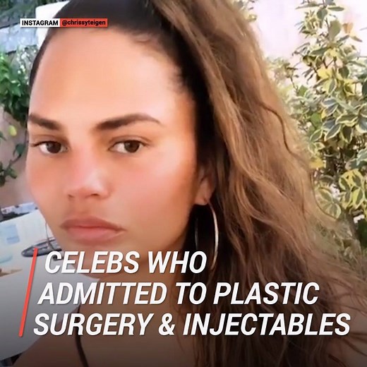 2.8M views · 99 reactions | From Cardi B to the Chrissy Teigen, these celebs have NO shame about getting plastic surgery. | Cosmopolitan | Facebook