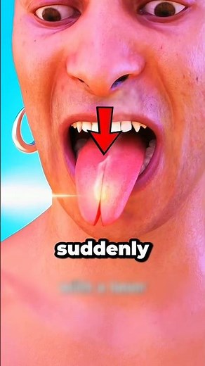 How To Deal With Tounge Burn? 😨
