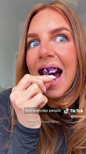 Achieve Bright Smiles with HiSmile Whitening Strips