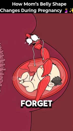 Mrs_Gynecologist on Instagram: "How Mom’s Belly Shape Changes During Pregnancy 🤰✨..!!#health #fypシ #foryou #animation #shorts In this emotional and educational 3D animation from @mrs_Gynecologist, the baby, stomach, and relatives all chime in as the pregnant belly suddenly becomes tight, pointy, and hard to control. While the family insists it means “a grandson,” the doctor reveals the real reason: abdominal muscle separation, also known as diastasis recti. This condition can make the belly loo