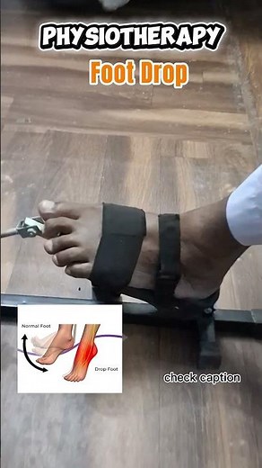 “Foot Drop Recovery Exercises (Must Watch!)”