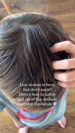 📌 Save this for when you might need it! Dealing with head lice can feel overwhelming 😵‍💫 but knowing how to safely tackle it will give you confidence. Fall and winter = close classrooms, hats, coats, sleepovers… and yes, more head lice. Thankfully, there are effective, safer ways to handle lice without exposing your family to some of the most aggressive pesticides still sold for children’s heads.😱 Many conventional options don’t work anymore because over 99% of lice have adapted and become r