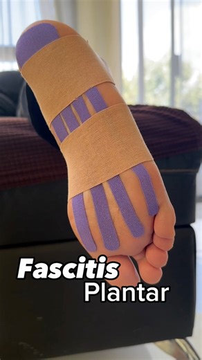 Dolor en la planta del pie? 👣Este vendaje Neuromuscular ayuda a reducir la tensión, mejorar la circulación y aliviar la fascitis plantar desde el primer paso. #kinetape #fascitisplantar #fblifestyle #KinesioTape | Kinetape Academy