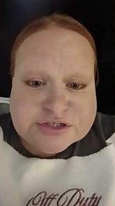 update on Nevro Spinal Cord Stimulator