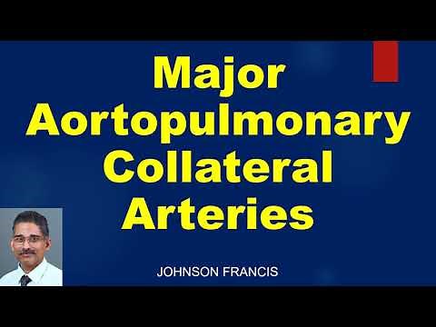 Major Aortopulmonary Collateral Arteries