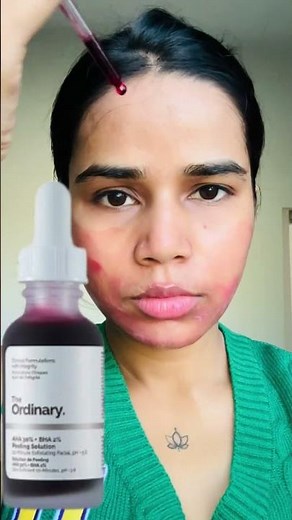 The ordinary AHA 30% + BHA 2% peeling solution is so good! #theordinaryskincare #ahabha