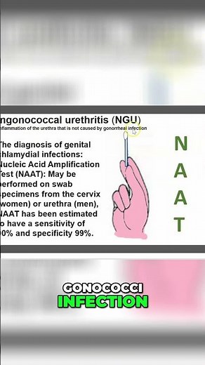 Non-Gonococcal Urethritis NGU Explained: Symptoms, Diagnosis, and Treatment Options #shorts