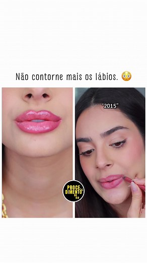 Nova Técnica de Contorno Labial versus Tradicional: Qual Escolher?