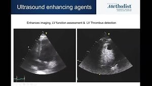Appropriate Use of Echocardiography & Doppler: What Are the Indications for Echocardiography? What Are the Appropriate Use Criteria?