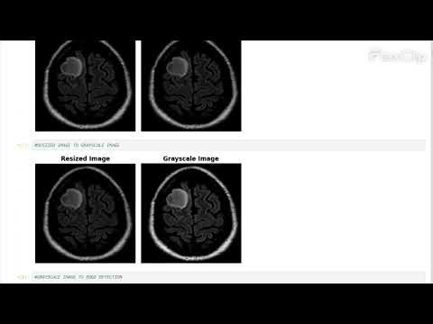 ARCHITECTURE OF A RESNET BASED DEEP LEARNING MODEL FOR MULTI CLASS BRAIN TUMOUR CLASSIFICATION