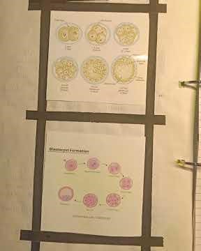 POST FERTILIZATION IN HUMAN BEING |INVESTIGATORY PROJECT | CBSE CLASS 12| #cbse12biology #education