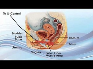 Pelvic Floor Biofeedback for Incontinence