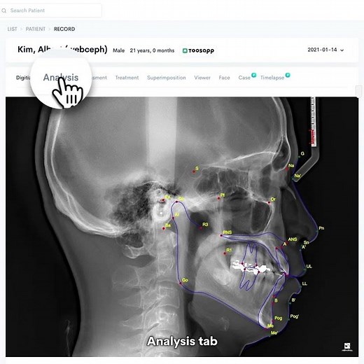 WEBCEPH Tutorial Shorts: Automated Cephalometric Tracing