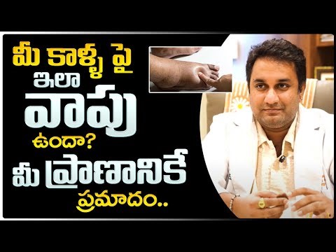 What is Gangrene, Types, Cause, Symptoms, & Treatment | Health Suggestions by Dr KVNN Santosh Murthy