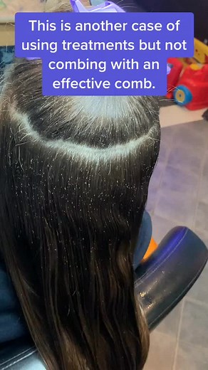 Effective Lice Egg Removal with Quality Comb