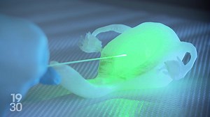 Un implant en hydrogel pour prévenir l'endométriose mis au point à Zurich | RTS