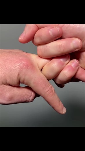 Understanding the Chattering Sound in Our Bones