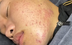 Relax Skincare Everyday with Loan Nguyen Beauty Spa # 032