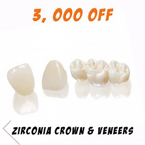 As Urban Smiles Dental Clinic turns 5, we are giving away exclusive deals and discounts on our services. ✅ 7,500 OFF - AIRNIVOL CLEAR ALIGNERS ✅ 3,000 OFF - ZIRCONIA/EMAX CROWNS AND VENEERS (per unit) ✅ 5,000 OFF - DENTAL IMPLANT ✅ 2,000 OFF - FLEXIBLE DENTURES (per arch/upper or lower) ✅ 3,000 OFF - IVOCAP DENTURES (per arch/ upper or lower) ✅ 5% OFF - ALL GENERAL SERVICES Promo runs from July 10 - 31 2018 only. So what are you waiting for? Book an appointment today. If you have inquiries: Cont