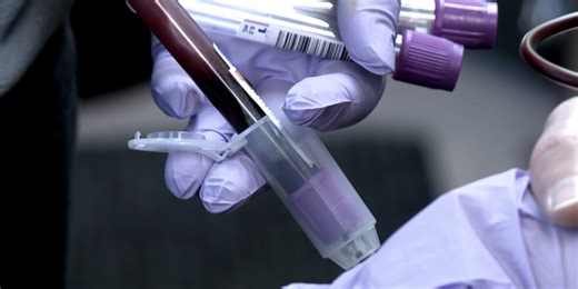 Rotary Club of Bridgeport to host wellness blood screening event