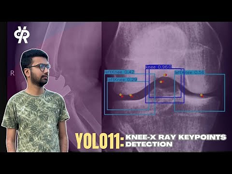Knee X-Ray Keypoints Detection with YOLO11 | Pose Estimation Training